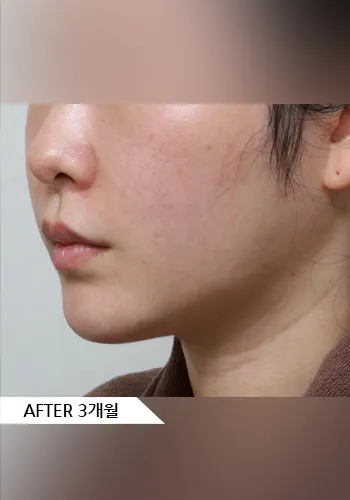 After