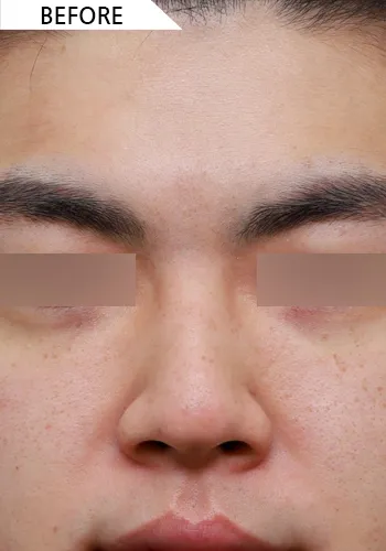 Before