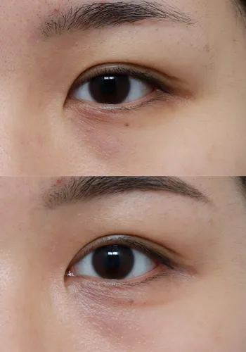 After