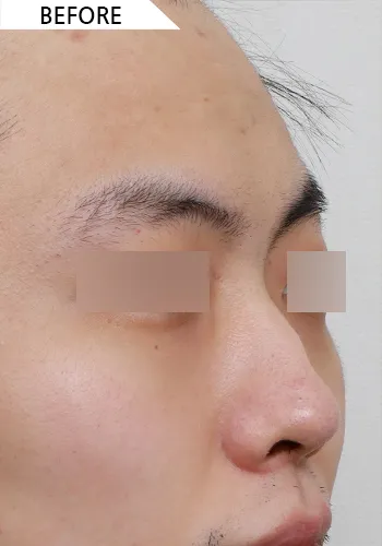 Before