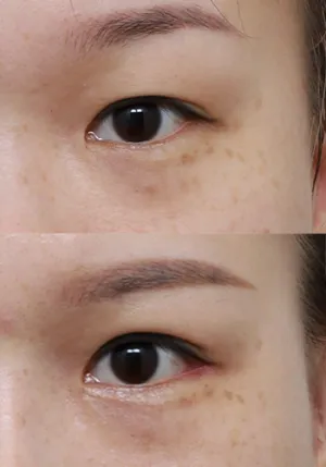 After