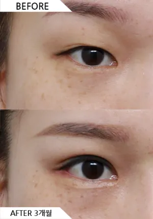 Before
