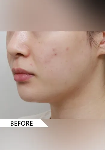 Before