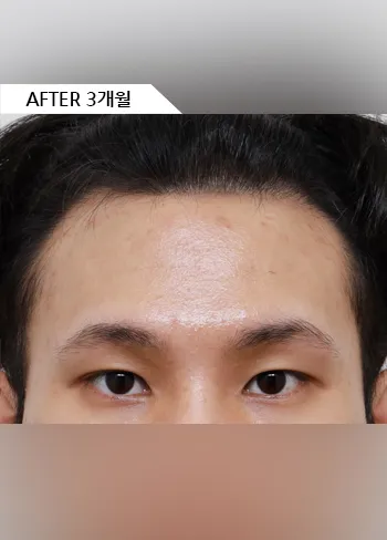 After