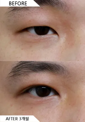 Before