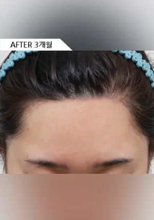 After