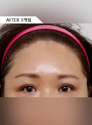 After