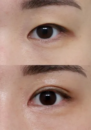 After