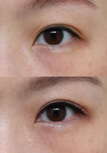 After