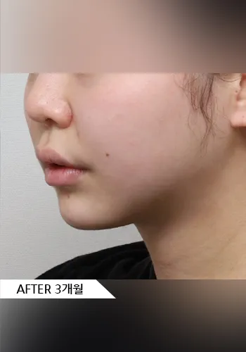 After