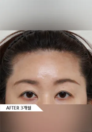 After