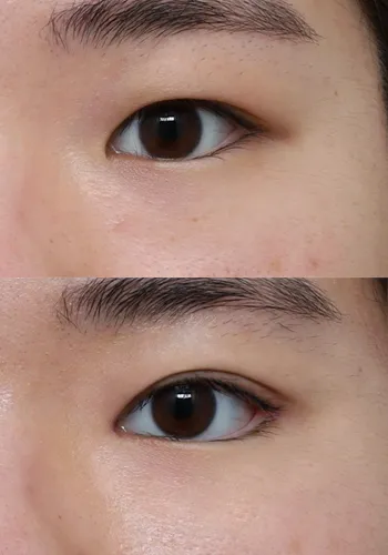 After