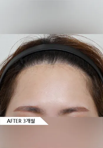 After