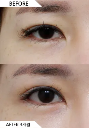 Before