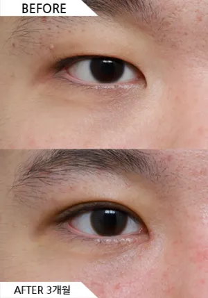 Before