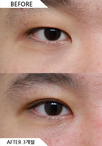 Before