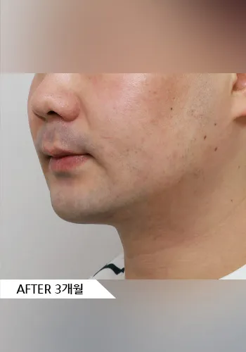 After