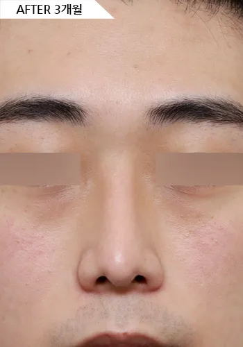 After