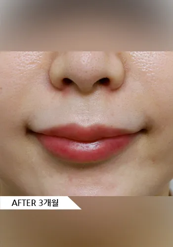 After