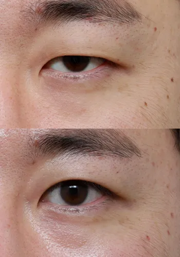 After
