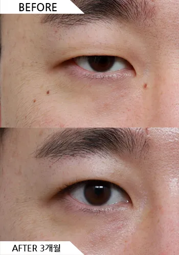 Before