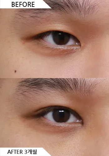 Before