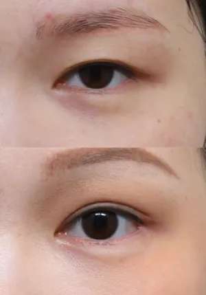 After
