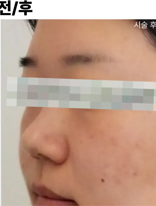 After