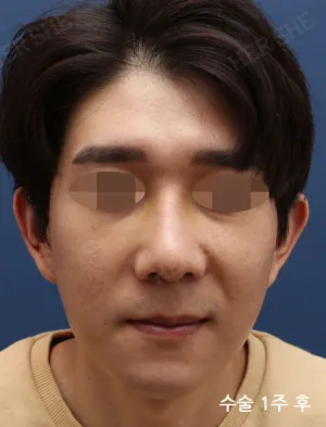After