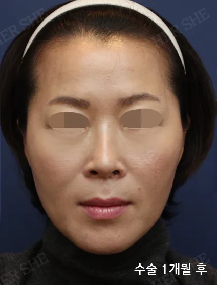 After