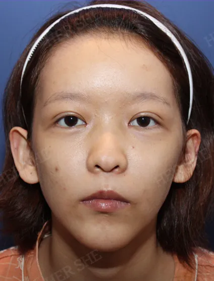 Before