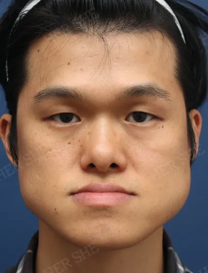 Before