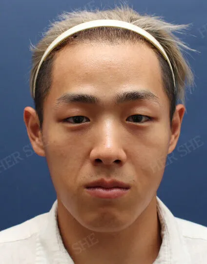 Before