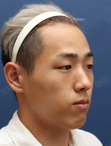 Before