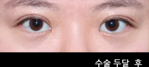 After