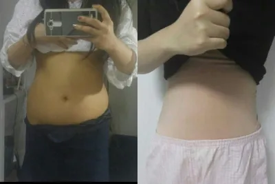 몸매가 바뀌니 자신감이 없던 자신감이 생겼어요!!ㅎㅎ