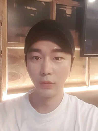 실리프팅과 이마지방이식을 받았어요~