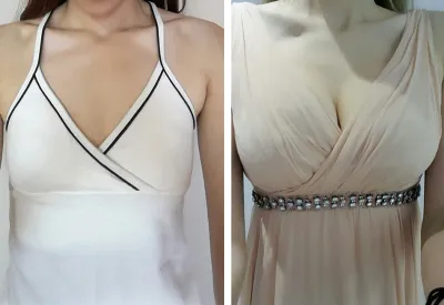 가슴 후기예요~