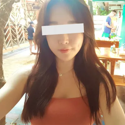 ★광대축소술 1년반 후기★