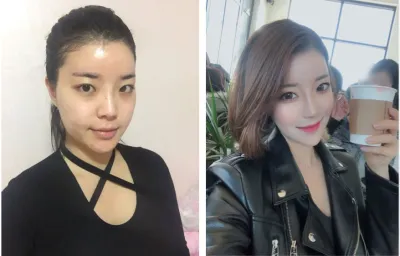 제이준에서 윤곽 4종 받았어요~