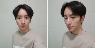 안면윤곽, 코성형, 풀페이스지방이식