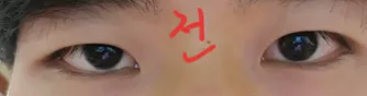 #제이준 눈매교정후기