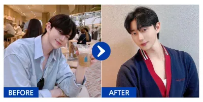 [강남언니] 눈지재 / 1개월차 / 닉네임 : 없는게뭐야씹