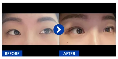 [강남언니] 자연유착 / 3일차 / 닉네임 : CassieYu