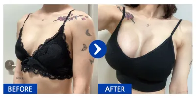 [바비톡] 가슴(모티바) / 2주차 / 닉네임:곰돌이삼형제