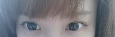 [눈] 무비스타7 - 뒤트임, 밑트임