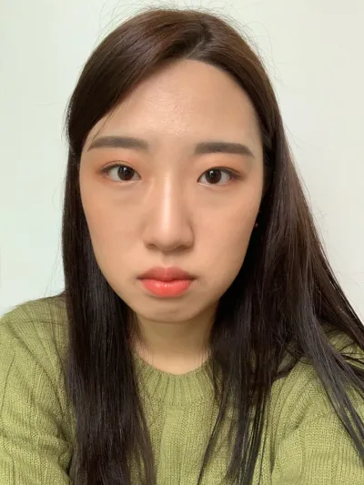 [눈] 샤랄라 - 비절개눈매교정, 앞트임, 눈밑지방재배치