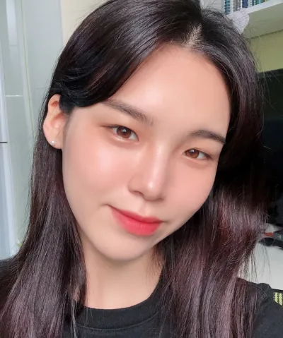 [눈] 강해 - 매몰쌍꺼풀(재수술)