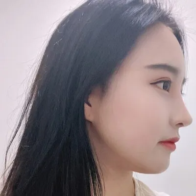 [코] 겨울쪼아 - 콧대 코끝 절골