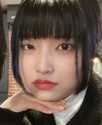 [눈] 짱녕 - 절개눈매교정 재수술